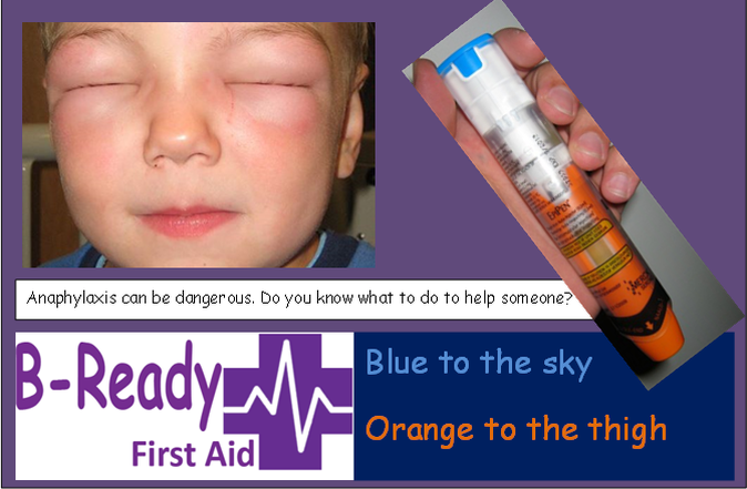 Anaphylaxis, blue to the sky orange to the thigh first aid training