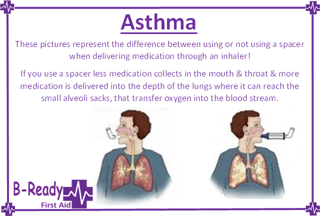 Asthma demonstrating the use of a spacer for First Aid emergency management