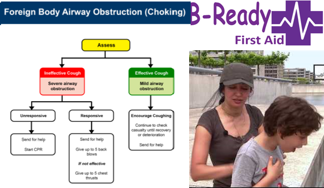 Choking Management for First Aid Trainnig by B-Ready First Aid