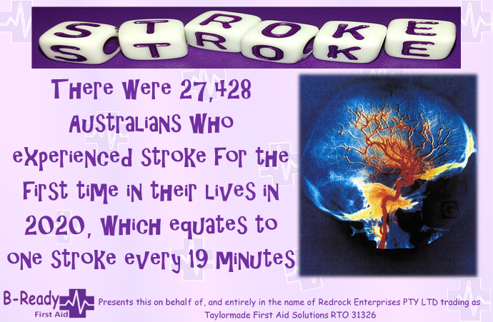 2020 stroke statistics= 1 stroke every 19 min in Australia 