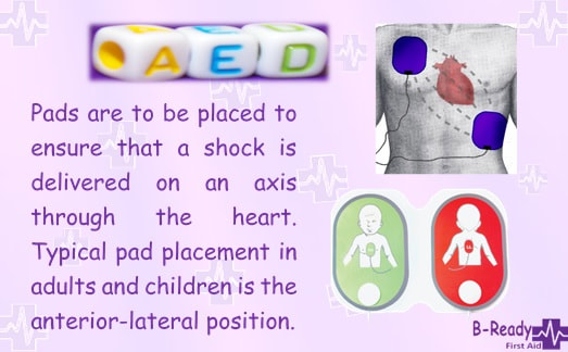 AED pad placement for children