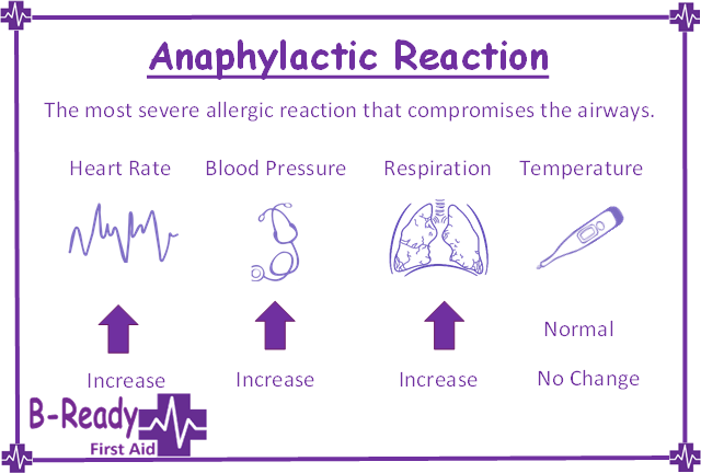 An anaphylactic reaction being the most severe raising the heart rate, blood pressure & respiration with no change to body temperature by B-Ready First Aid & CPR