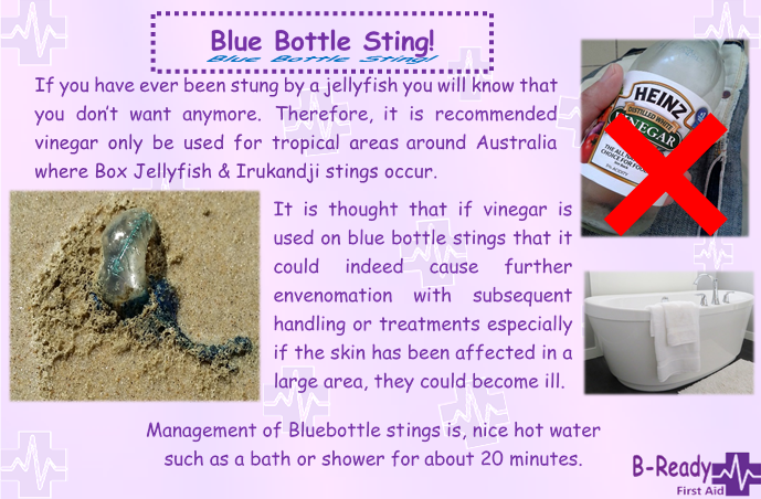 Picture about blue bottle sting management for First Aid