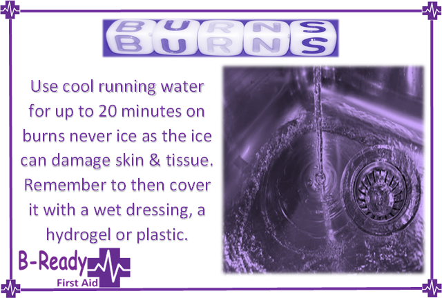 Picture of running water into a sink and text explaining to use cool running water for up to 20 minutes on burns, never use ice as the ice can damage skin & tissue. Remember to them cover it with a wet dressing or plastic.