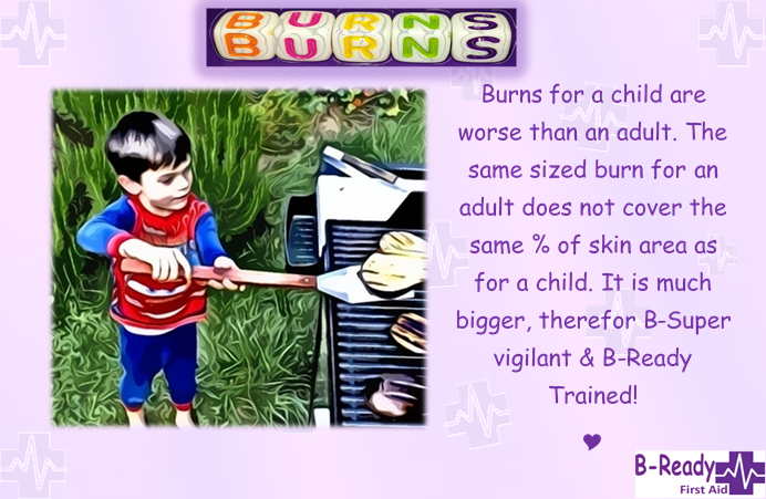 B-Ready First Aid info about Burns & Children being more significant B-Safe 