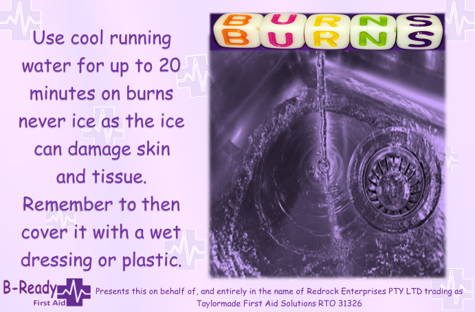 Picture of running water into a sink and text explaining to use cool running water for up to 20 minutes on burns, never use ice as the ice can damage skin & tissue. Remember to them cover it with a wet dressing or plastic.