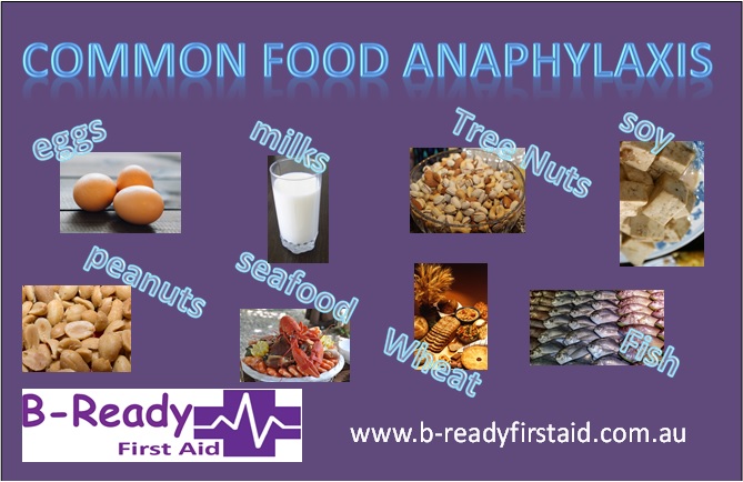 Common Food Anaphylaxis by B- Ready First Aid