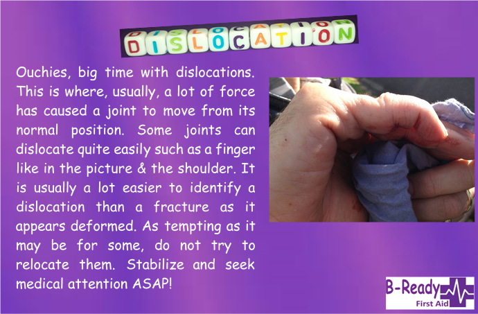 B-Ready First Aid information about dislocation management