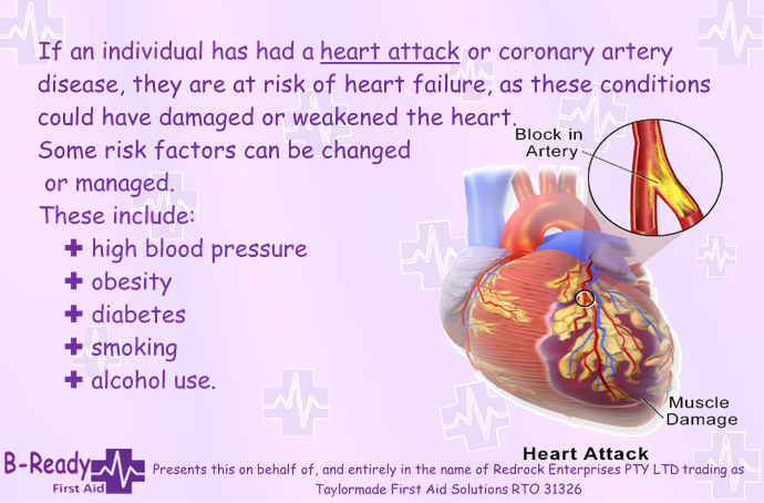 Heart attack and heart failure, know the signs & learn CPR