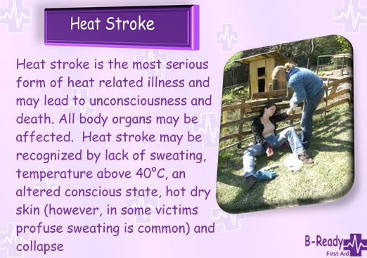Heat Stroke is so serious and can lead to death