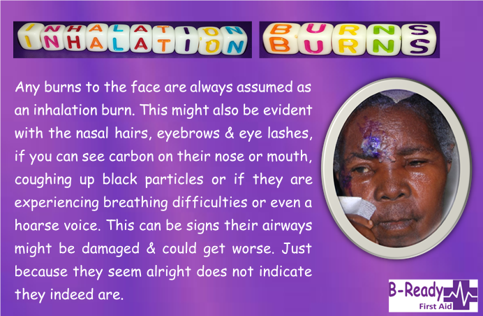 B-Ready First Aid info about inhalation burns or tips for first aid assistance
