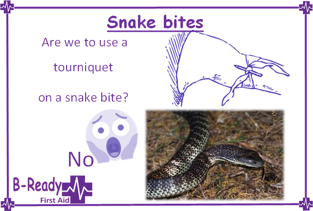 Using a Tourniquet on snake bites is a No in first aid