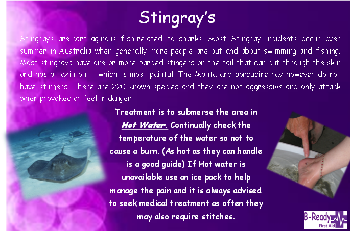 First Aid Stingray management by B-Ready First Aid