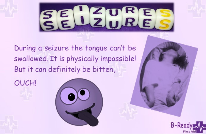 B-Ready First Aid info about seizures & swallowing the tongue