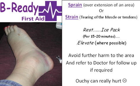 Sprain or Strain management for firstaiders by B-Ready First Aid