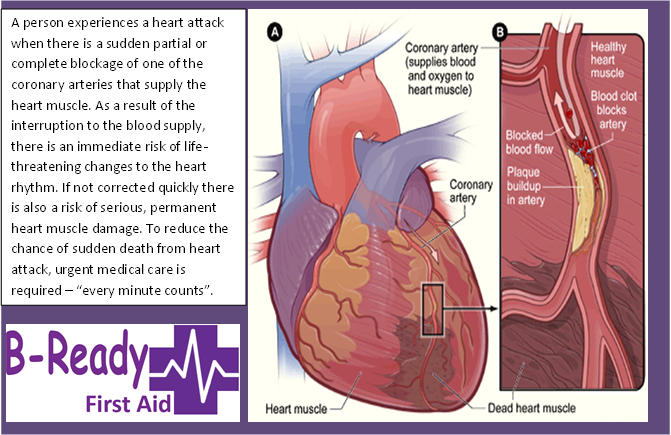 Heart Attack info by B-Ready First Aid