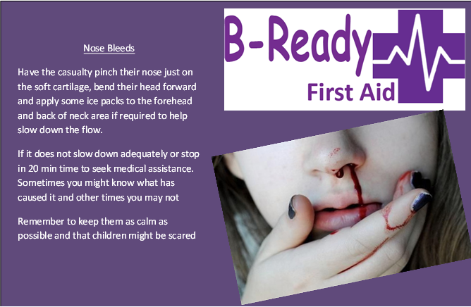 B-Ready First Aid info about managing a nose bleeds